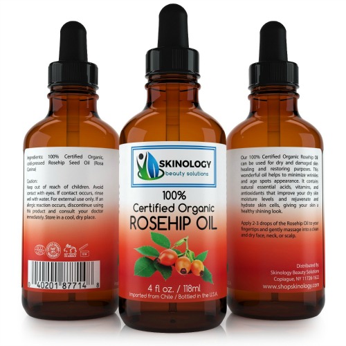 Skinology Rosehip Oil {Review}